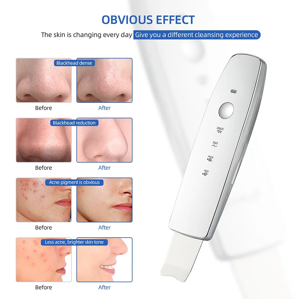 EMS Pulse Ion Face Skin Scrubber