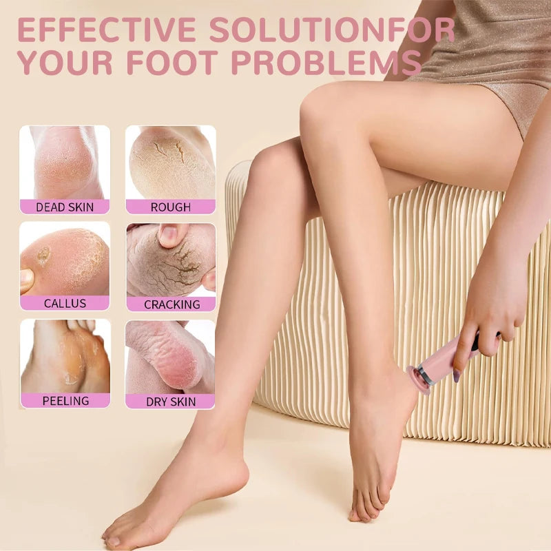 Electric Foot Callus Remover