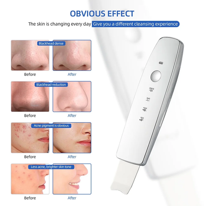 EMS Pulse Ion Face Skin Scrubber